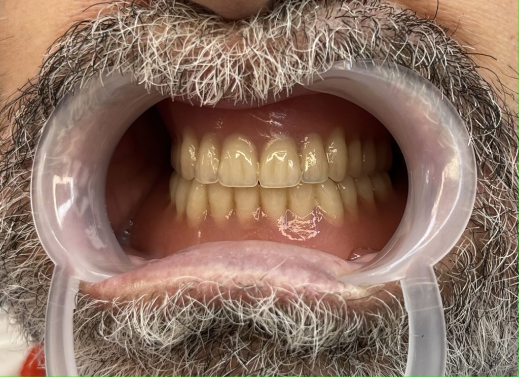 protetica dentara sector 6